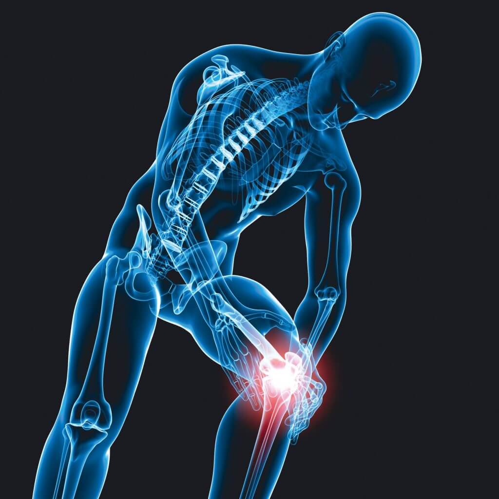 Neue Behandlungsmöglichkeit bei chronischen Knieschmerzen