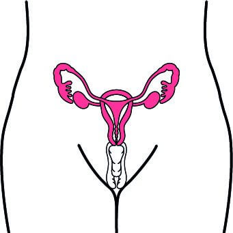 Endometriose – Die Ausnahme von der Regel