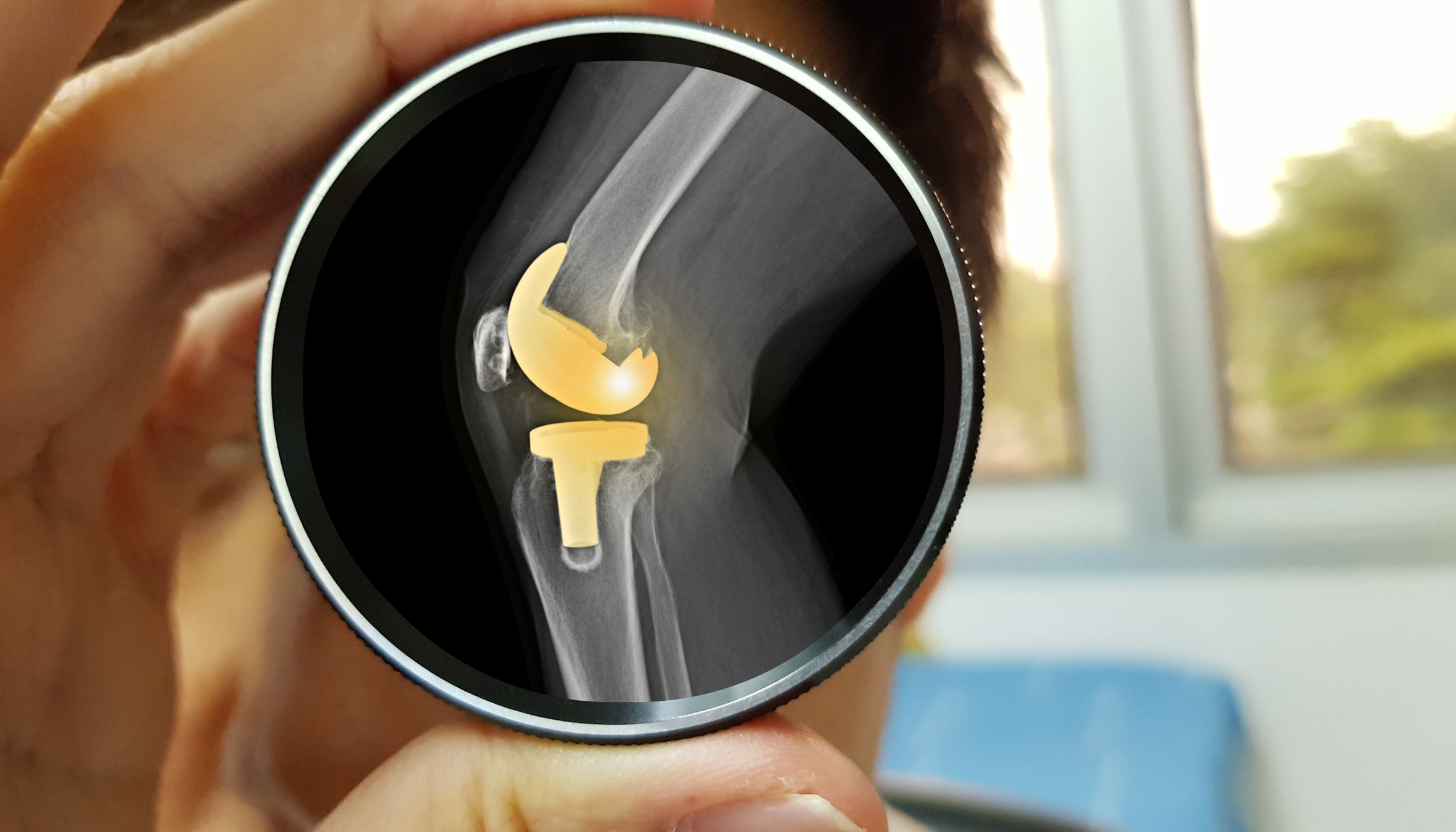 Die Knieprothese - Orthopress | Das neue Onlineportal rund um Ihre ...