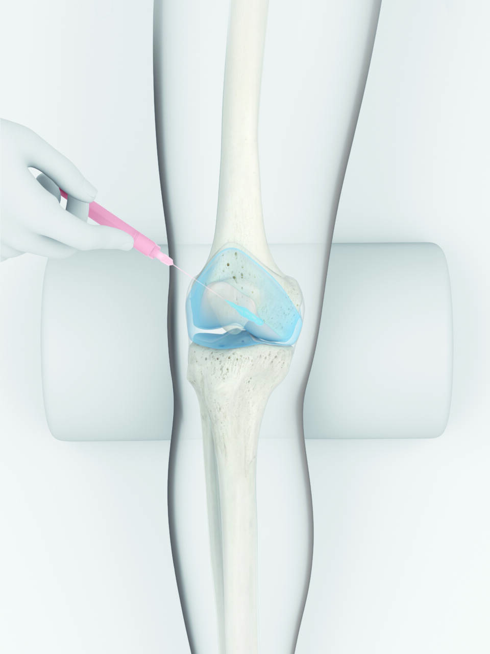 contura knee inject f