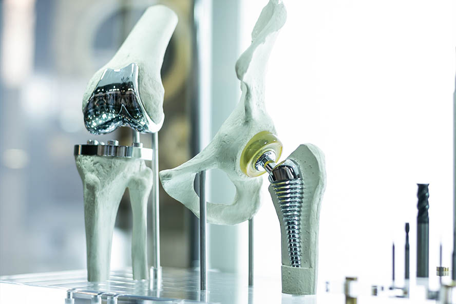 knee and hip prosthesis for medicine