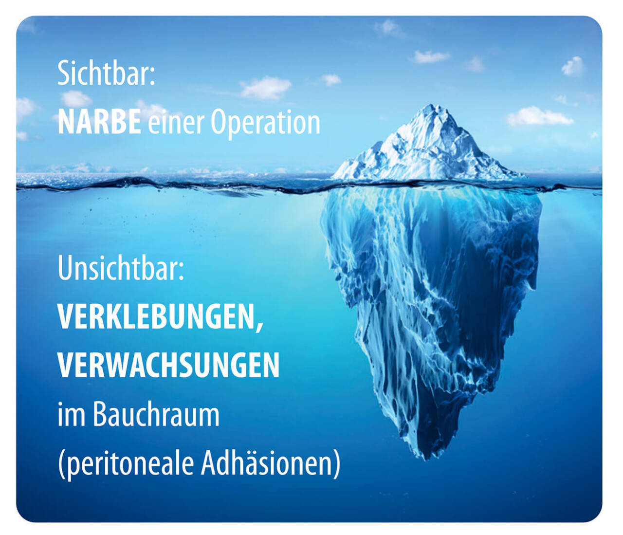 bornemann