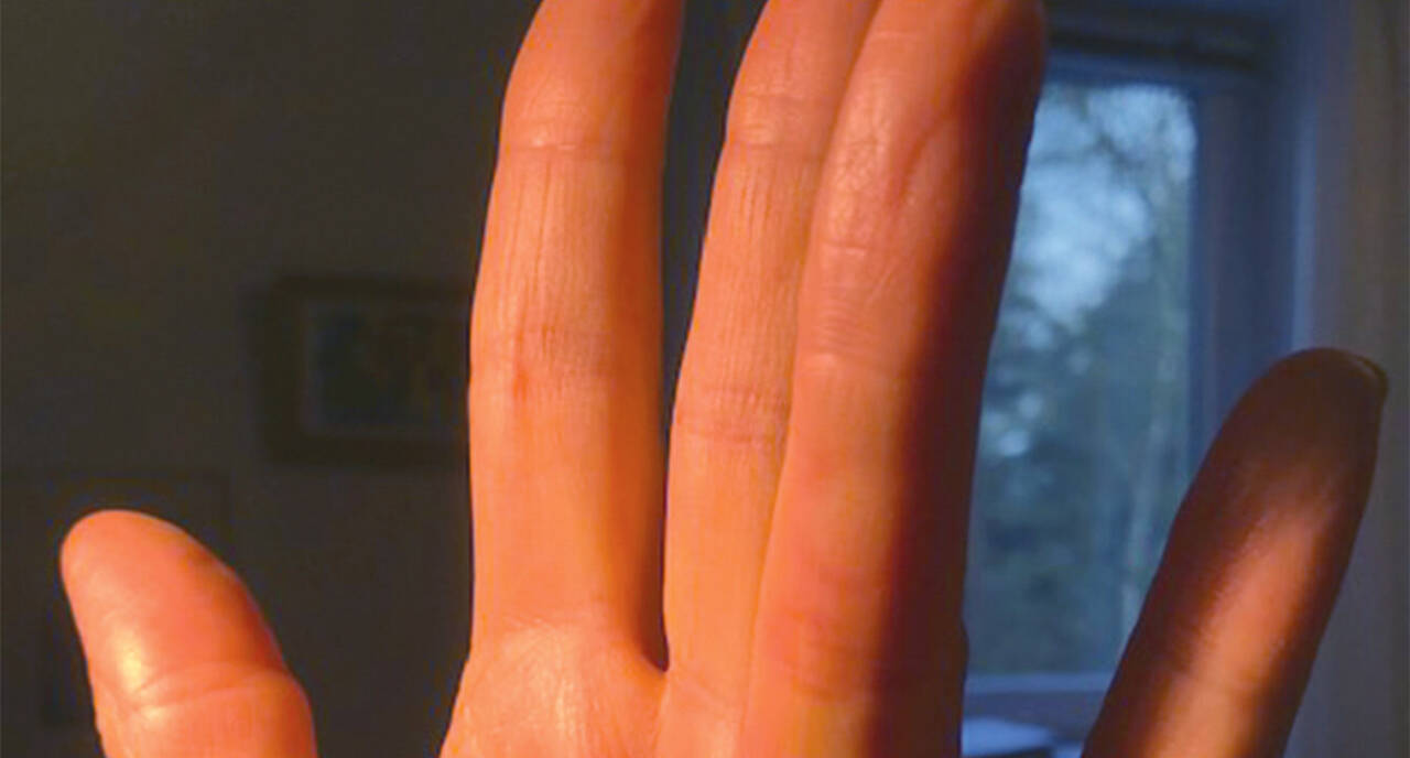 seegenschmiedt prof hand